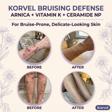 Korvel Bruising Defense